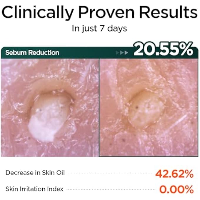 P.CALM BARRIER CYCLE DAILY SHEET MASK PACK 30 DAYS | KOREAN NON COMEDOGENIC DAILY MOISTURIZING TREATMENT SHEET MASK FOR SENSITIVE SKIN | VEGAN CRUELTY FREE - Image 4